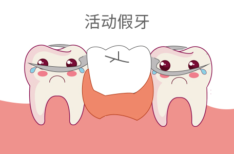 假牙